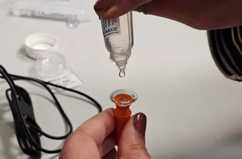 A mini scleral lens on plunger. Saline fills the lens.