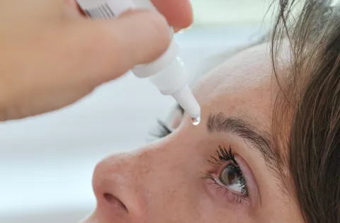 Woman holds a bottle of eye drops above her open eye