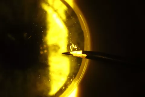 Needle piercing SimulEYE® model eye, viewed through slit lamp